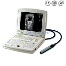 Ysb5000 medizinische volle digitale tragbare Ultraschallmaschine